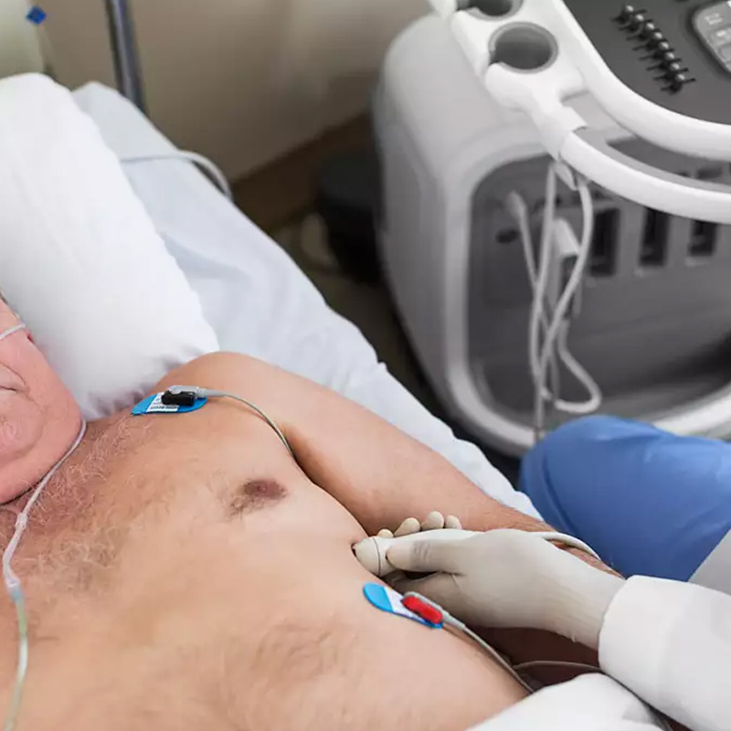 Ультразвуковая система экспертного класса Philips Affiniti CVx